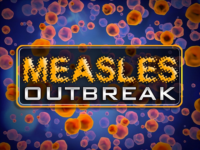 Measles Virus